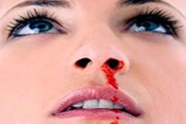 Thuốc nam chữa chảy máu cam