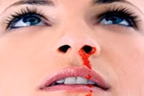 Thuốc nam chữa chảy máu cam