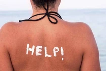 Cháy nắng trong ngày râm mát, vì sao?