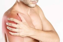 Viêm quanh khớp vai