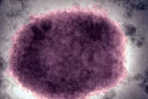 Virus đậu mùa khỉ trong mụn nước ở người bệnh.