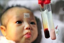Sàng lọc bệnh Thalassemia trước kết hôn