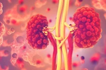 Bệnh thận đa nang trẻ em 