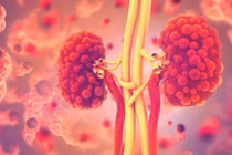 Bệnh thận đa nang trẻ em 