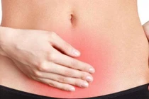 HPV DNA- xét nghiệm đầu tay trong tầm soát ung thư cổ tử cung 