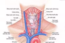 Điều trị đích trong ung thư tuyến giáp
