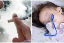 Bố hút thuốc lá con viêm phế quản bội nhiễm 