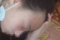 Đi mua kim, nữ sinh lớp 10 bị đánh chấn động não