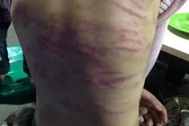 Khởi tố đôi nhân tình xâm hại, bạo hành bé gái 12 tuổi