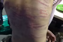 Khởi tố đôi nhân tình xâm hại, bạo hành bé gái 12 tuổi