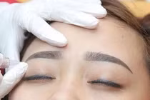 Bệnh nhân hôn mê sau khi xăm chân mày đã tử vong