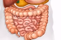 Hội chứng ruột kích thích ở người cao tuổi