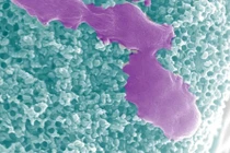 Vi robot chạy bằng ure điều trị nhiễm trùng đường tiết niệu