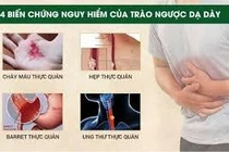 Vỡ thực quản, ngất xỉu vì cố nôn