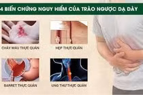 Vỡ thực quản, ngất xỉu vì cố nôn
