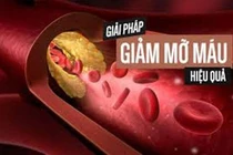 Làm thế nào để phát hiện rối loạn mỡ máu