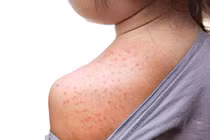 Nhiều dịch bệnh chực chờ bùng phát