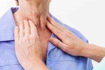 Bác sỹ cảnh báo thói quen xấu dẫn tới ung thư thực quản