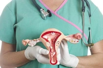 Ung thư buồng trứng: “Biết sớm, trị lành”