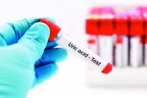 Cải thiện đau gút ở ngón chân cái bằng thảo dược - Hướng đi mới giúp điều trị bệnh hiệu quả