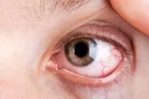 Đái tháo đường tuýp nào biến chứng mau hơn?