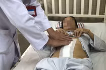 Ôm khối u buồng trứng hơn 7kg suốt 1 năm trong bụng