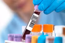 Tầm soát sớm ung thư bằng xét nghiệm máu