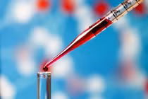 Nhóm máu có thể làm tăng nguy cơ ung thư