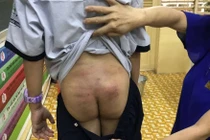 TPHCM: Nghi vấn bé trai bị bạo hành kéo dài khi ở cùng bố, mẹ kế