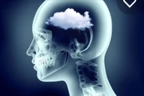 Cách vượt qua tình trạng "sương mù não" hậu COVID-19