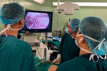 Trường hợp nào được nội soi cắt ung thư gan?