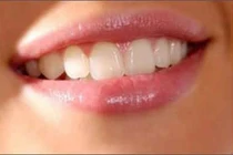 Bôi gì khi bị khô, nứt môi?