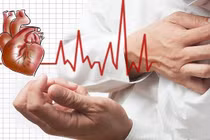 Xử lý khi bị nhồi máu cơ tim