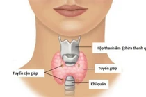 Tổn thương tuyến cận giáp