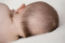 Nhận biết trẻ thiếu vi chất