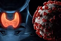 bệnh tuyến giáp