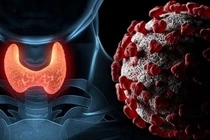 bệnh tuyến giáp