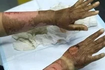 Sử dụng nước rửa tay khô an toàn