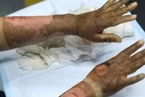 Sử dụng nước rửa tay khô an toàn