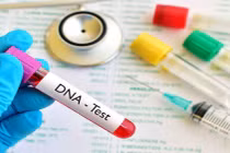 Khó xét nghiệm AND hài cốt liệt sỹ 