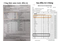 Phác đồ Lenalidomide – Dexamethasol liều thấp cứu bệnh nhân suy tủy do đa u tủy xương