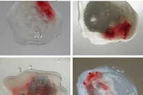 Tinh dịch màu gỉ sắt