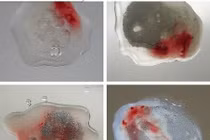 Tinh dịch màu gỉ sắt