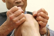 Tại sao thời tiết thay đổi lại đau xương khớp?