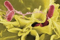 Biến chứng chết người do vi khuẩn Shigella