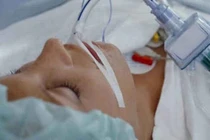 Dấu hiệu nhiễm toan ceton