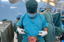 Đắp lá cây khiến khối u ở âm hộ bùng phát