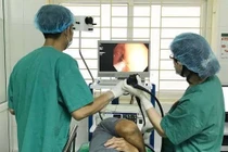 Lại một trường hợp thủng dạ dày vì ngậm tăm