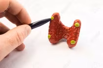 Phẫu thuật không có lợi ích gì ở bệnh nhân cường cận giáp nhẹ