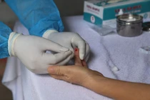 Cô gái Hà Nội dương tính nCoV khi đến Pháp